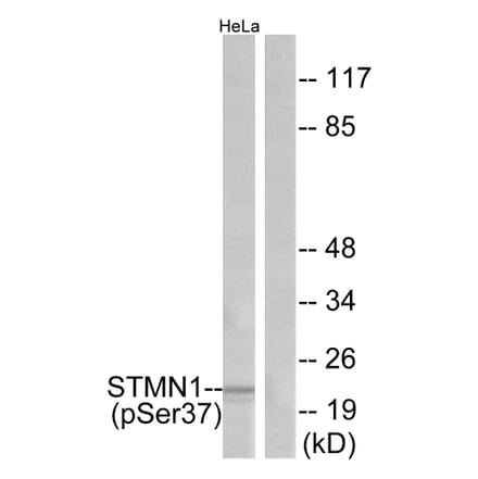 Western Blot - Anti-Stathmin 1 (phospho Ser37) Antibody (A7232) - Antibodies.com