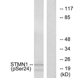 Western Blot - Anti-Stathmin 1 (phospho Ser24) Antibody (A7231) - Antibodies.com