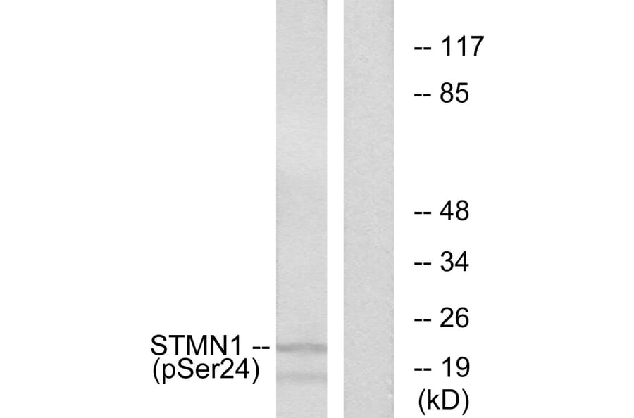 Western Blot - Anti-Stathmin 1 (phospho Ser24) Antibody (A7231) - Antibodies.com