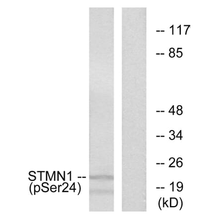 Western Blot - Anti-Stathmin 1 (phospho Ser24) Antibody (A7231) - Antibodies.com