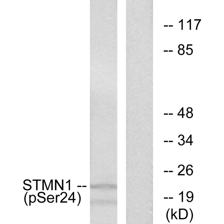 Western Blot - Anti-Stathmin 1 (phospho Ser24) Antibody (A7231) - Antibodies.com