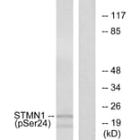 Western Blot - Anti-Stathmin 1 (phospho Ser24) Antibody (A7231) - Antibodies.com