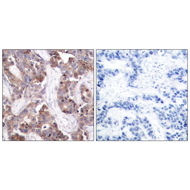 Immunohistochemistry - Anti-Stathmin 1 (phospho Ser24) Antibody (A7231) - Antibodies.com