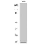 Western Blot - Anti-Stathmin 1 (phospho Ser24) Antibody (A7231) - Antibodies.com