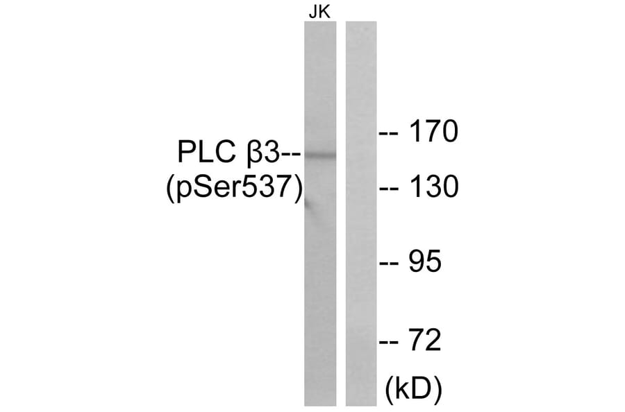 Western Blot - Anti-PLC beta3 (phospho Ser537) Antibody (A0722) - Antibodies.com