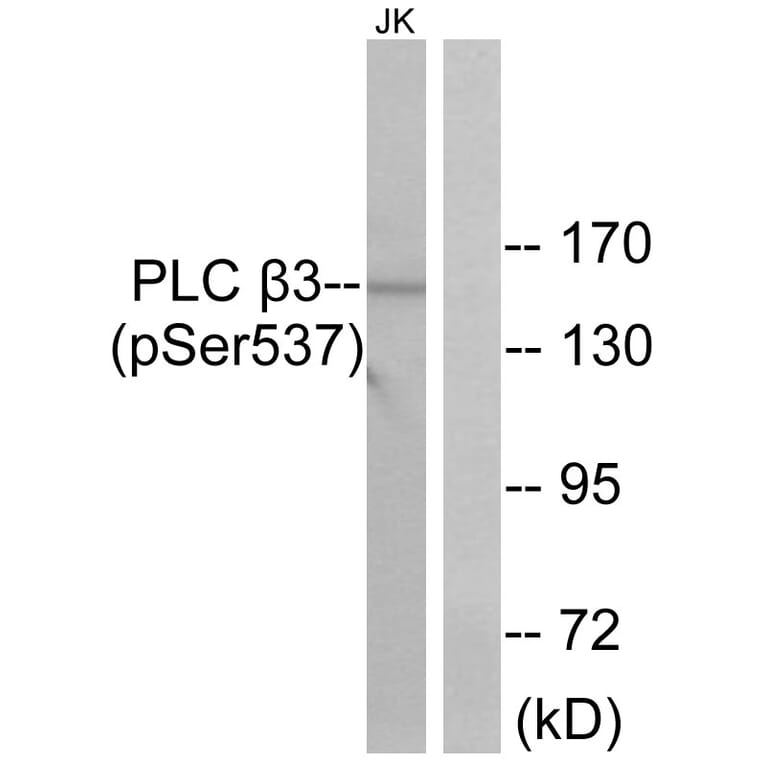 Western Blot - Anti-PLC beta3 (phospho Ser537) Antibody (A0722) - Antibodies.com