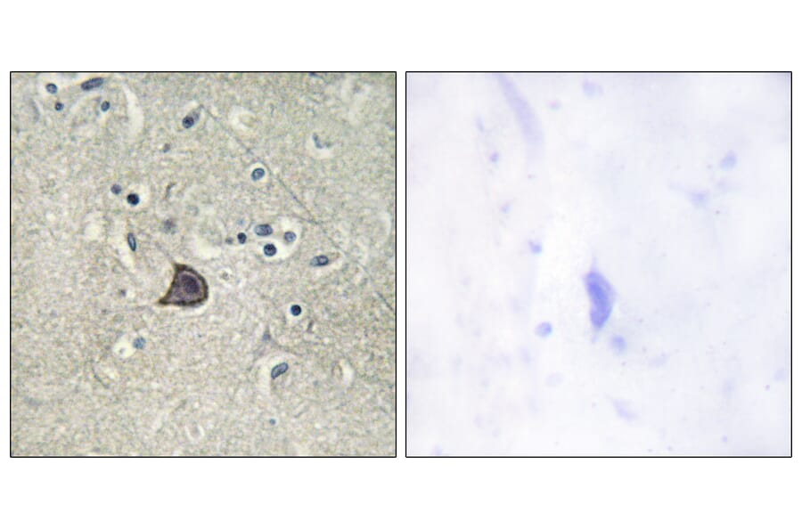 Immunohistochemistry - Anti-PLC beta3 (phospho Ser537) Antibody (A0722) - Antibodies.com