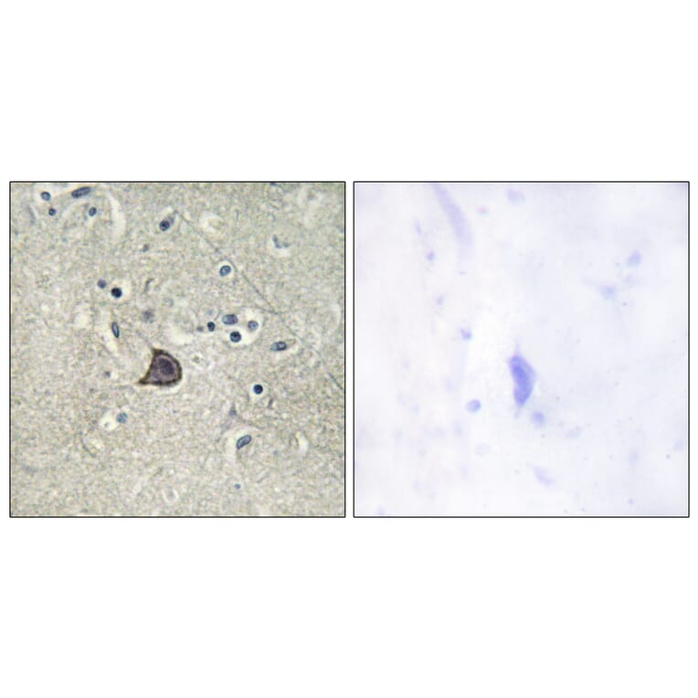 Immunohistochemistry - Anti-PLC beta3 (phospho Ser537) Antibody (A0722) - Antibodies.com