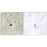 Immunohistochemistry - Anti-PLC beta3 (phospho Ser537) Antibody (A0722) - Antibodies.com