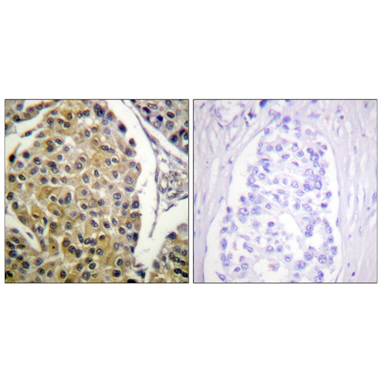 Immunohistochemistry - Anti-PKC delta (phospho Tyr313) Antibody (A0718) - Antibodies.com