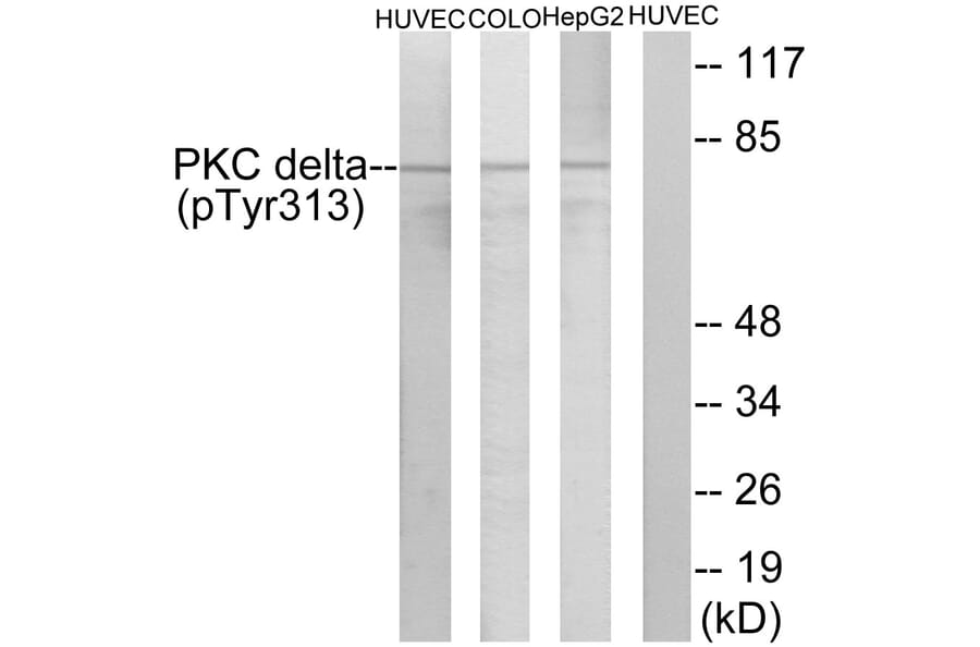 Western Blot - Anti-PKC delta (phospho Tyr313) Antibody (A0718) - Antibodies.com
