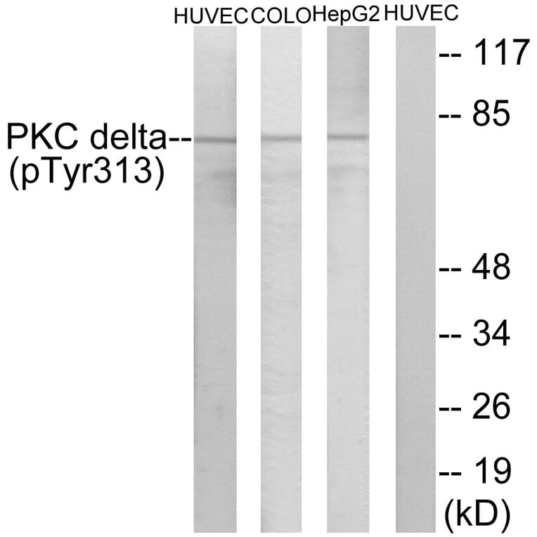 Western Blot - Anti-PKC delta (phospho Tyr313) Antibody (A0718) - Antibodies.com