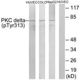 Western Blot - Anti-PKC delta (phospho Tyr313) Antibody (A0718) - Antibodies.com