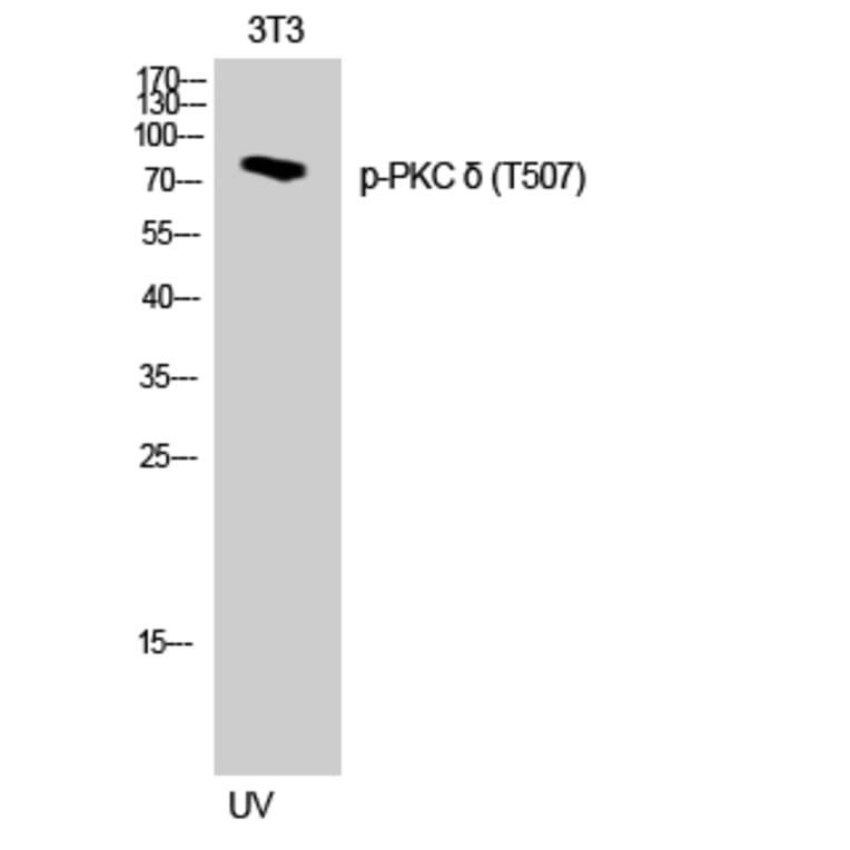 Western Blot - Anti-PKC delta (phospho Thr505) Antibody (A0717) - Antibodies.com