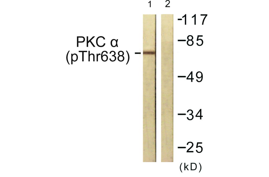Western Blot - Anti-PKC alpha (phospho Thr638) Antibody (A0716) - Antibodies.com
