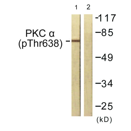 Western Blot - Anti-PKC alpha (phospho Thr638) Antibody (A0716) - Antibodies.com