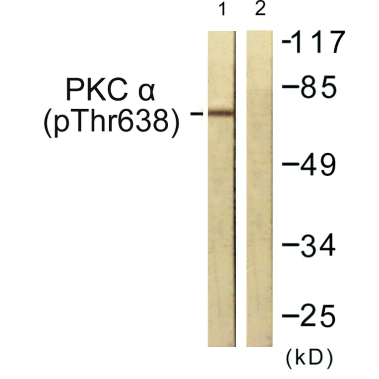 Western Blot - Anti-PKC alpha (phospho Thr638) Antibody (A0716) - Antibodies.com