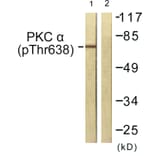 Western Blot - Anti-PKC alpha (phospho Thr638) Antibody (A0716) - Antibodies.com