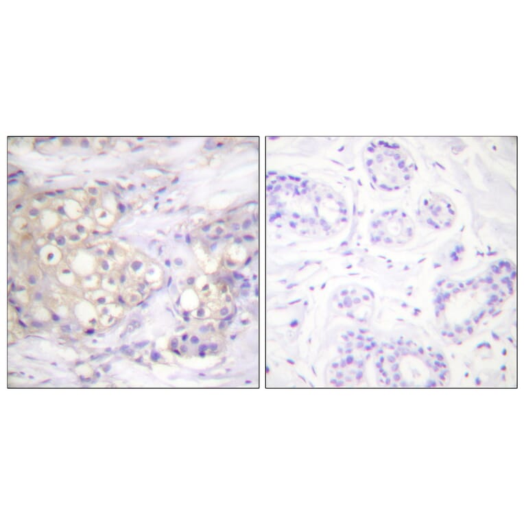 Immunohistochemistry - Anti-PKC alpha (phospho Thr638) Antibody (A0716) - Antibodies.com
