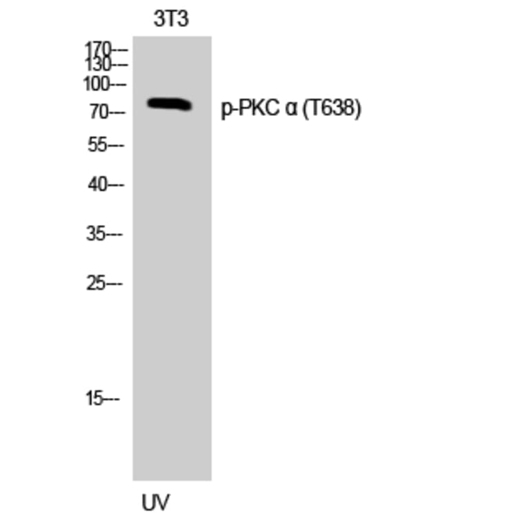Western Blot - Anti-PKC alpha (phospho Thr638) Antibody (A0716) - Antibodies.com