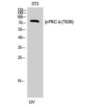 Western Blot - Anti-PKC alpha (phospho Thr638) Antibody (A0716) - Antibodies.com