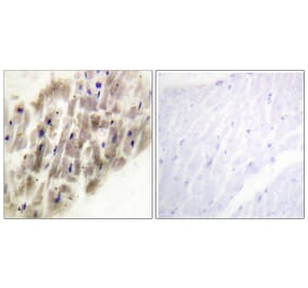 Immunohistochemistry - Anti-MAPKAPK-2 (phospho Thr222) Antibody (A0677) - Antibodies.com