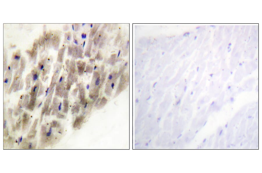 Immunohistochemistry - Anti-MAPKAPK-2 (phospho Thr222) Antibody (A0677) - Antibodies.com