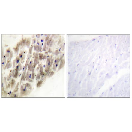 Immunohistochemistry - Anti-MAPKAPK-2 (phospho Thr222) Antibody (A0677) - Antibodies.com
