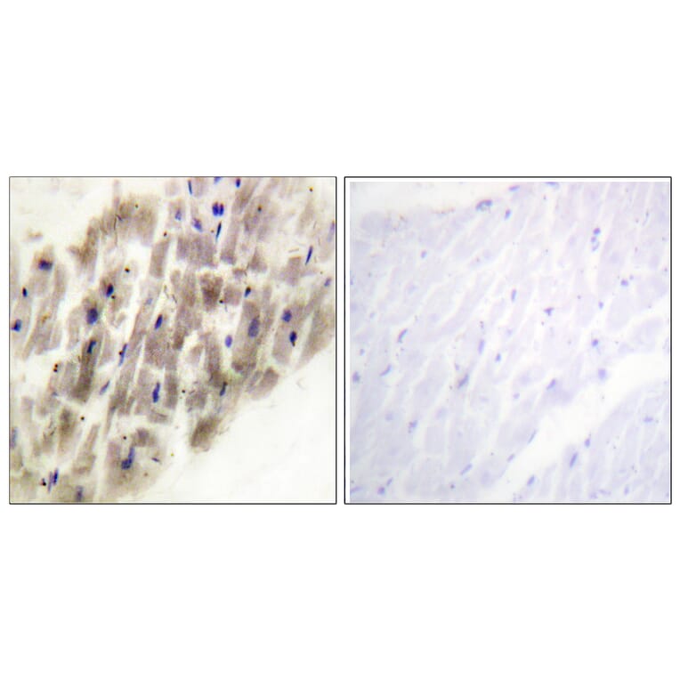 Immunohistochemistry - Anti-MAPKAPK-2 (phospho Thr222) Antibody (A0677) - Antibodies.com