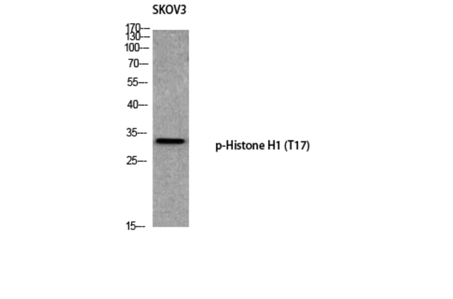 Western Blot - Anti-Histone H1 (phospho Thr17) Antibody (A0948) - Antibodies.com