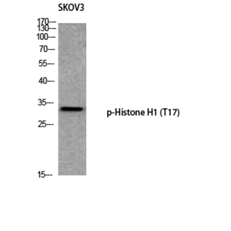Western Blot - Anti-Histone H1 (phospho Thr17) Antibody (A0948) - Antibodies.com