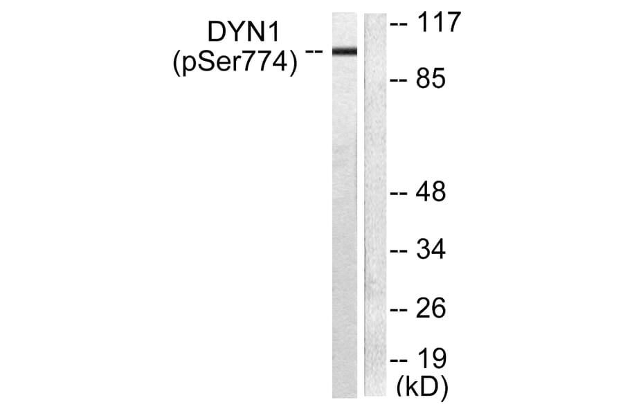 Western Blot - Anti-Dynamin-1 (phospho Ser774) Antibody (A0422) - Antibodies.com