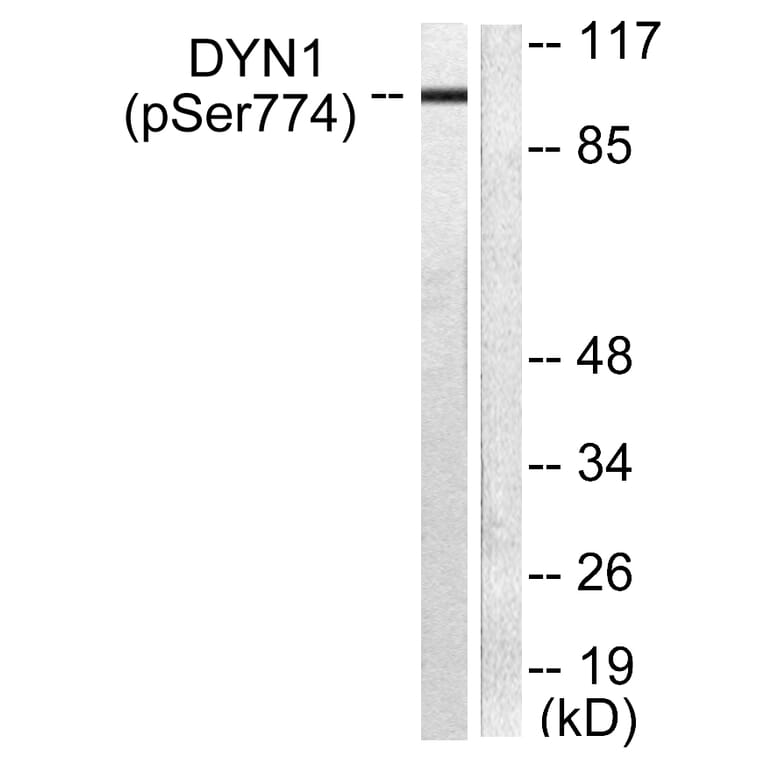 Western Blot - Anti-Dynamin-1 (phospho Ser774) Antibody (A0422) - Antibodies.com