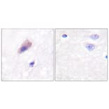 Immunohistochemistry - Anti-Dynamin-1 (phospho Ser774) Antibody (A0422) - Antibodies.com