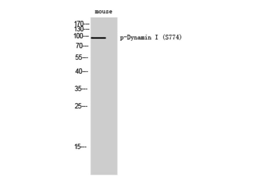 Western Blot - Anti-Dynamin-1 (phospho Ser774) Antibody (A0422) - Antibodies.com