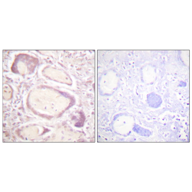 Immunohistochemistry - Anti-Cyclin B1 (phospho Ser147) Antibody (A0635) - Antibodies.com