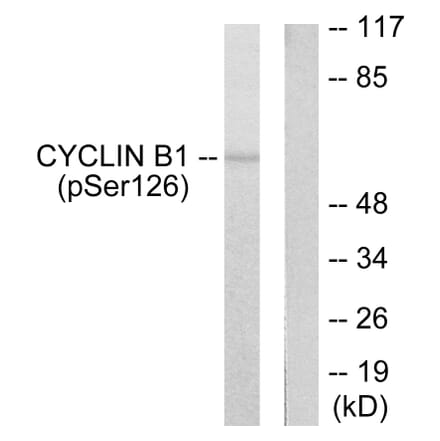 Western Blot - Anti-Cyclin B1 (phospho Ser126) Antibody (A0068) - Antibodies.com