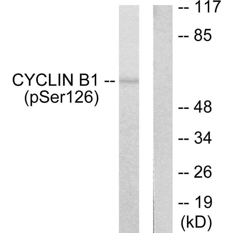 Western Blot - Anti-Cyclin B1 (phospho Ser126) Antibody (A0068) - Antibodies.com