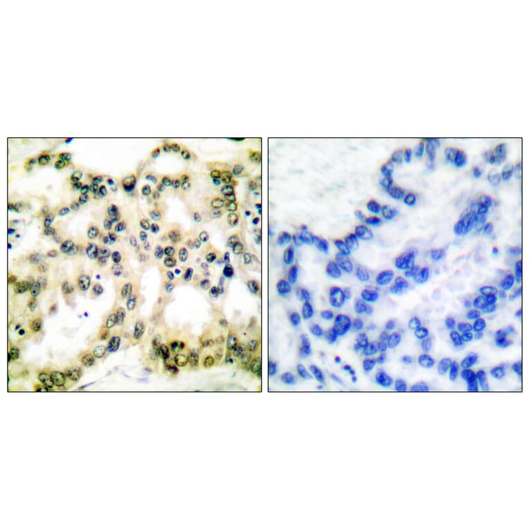 Immunohistochemistry - Anti-Cyclin B1 (phospho Ser126) Antibody (A0068) - Antibodies.com