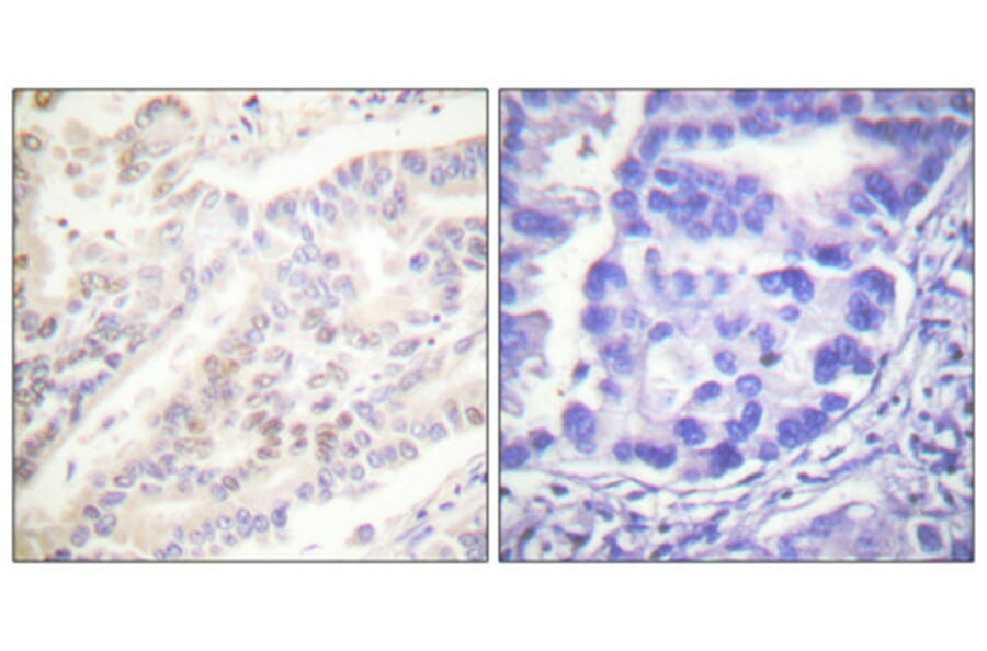 Immunohistochemistry - Anti-Cyclin B1 (phospho Ser126) Antibody (A0068) - Antibodies.com