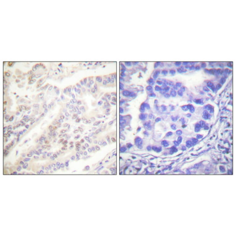 Immunohistochemistry - Anti-Cyclin B1 (phospho Ser126) Antibody (A0068) - Antibodies.com