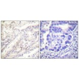 Immunohistochemistry - Anti-Cyclin B1 (phospho Ser126) Antibody (A0068) - Antibodies.com