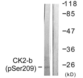 Western Blot - Anti-CKII-beta (phospho Ser209) Antibody (A0869) - Antibodies.com