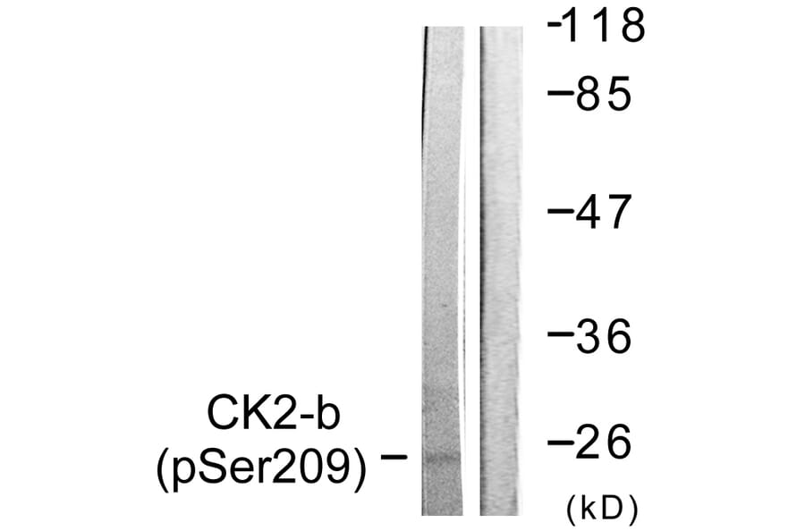 Western Blot - Anti-CKII-beta (phospho Ser209) Antibody (A0869) - Antibodies.com