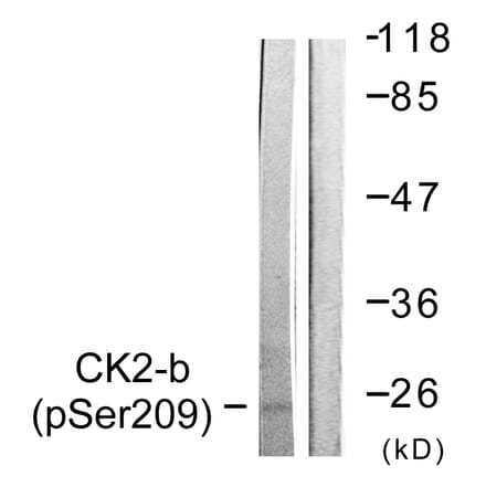 Western Blot - Anti-CKII-beta (phospho Ser209) Antibody (A0869) - Antibodies.com
