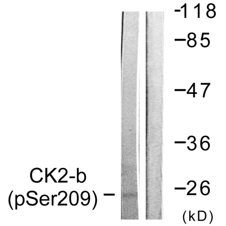 Western Blot - Anti-CKII-beta (phospho Ser209) Antibody (A0869) - Antibodies.com