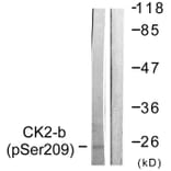 Western Blot - Anti-CKII-beta (phospho Ser209) Antibody (A0869) - Antibodies.com