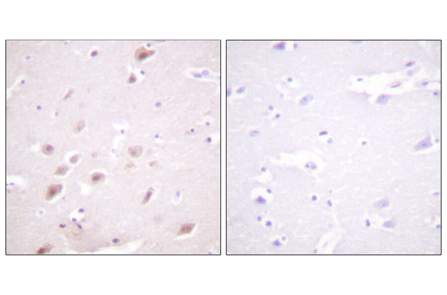 Immunohistochemistry - Anti-CKII-beta (phospho Ser209) Antibody (A0869) - Antibodies.com