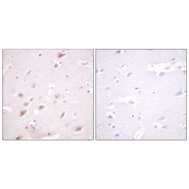 Immunohistochemistry - Anti-CKII-beta (phospho Ser209) Antibody (A0869) - Antibodies.com