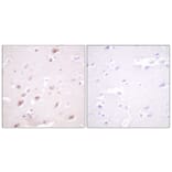 Immunohistochemistry - Anti-CKII-beta (phospho Ser209) Antibody (A0869) - Antibodies.com